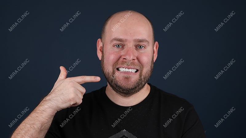 Full smile restoration review